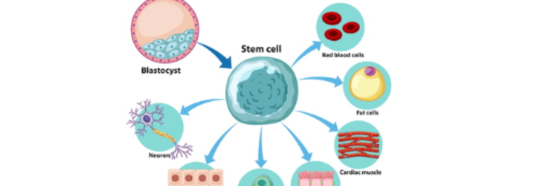 Affordable Stem Cell Transplant Cost in India