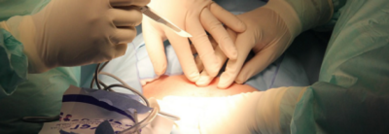 Fistula Removal Surgery In India