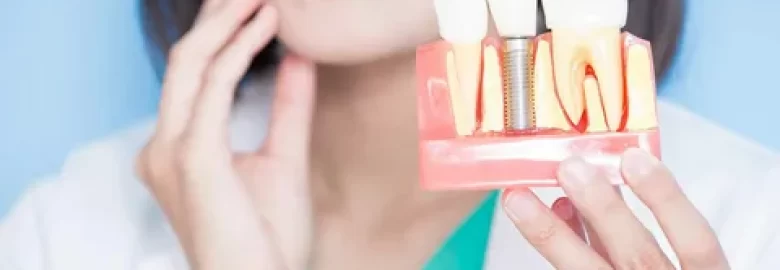 Dental implants in Islamabad